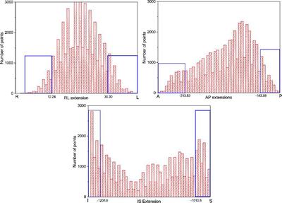 Account for the Full Extent of Esophagus Motion in Radiation Therapy Planning: A Preliminary Study of the IRV of the Esophagus